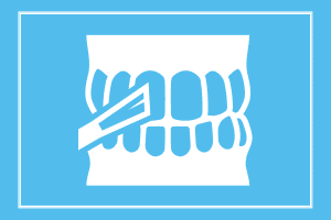 kids Dental Sealants st simons island